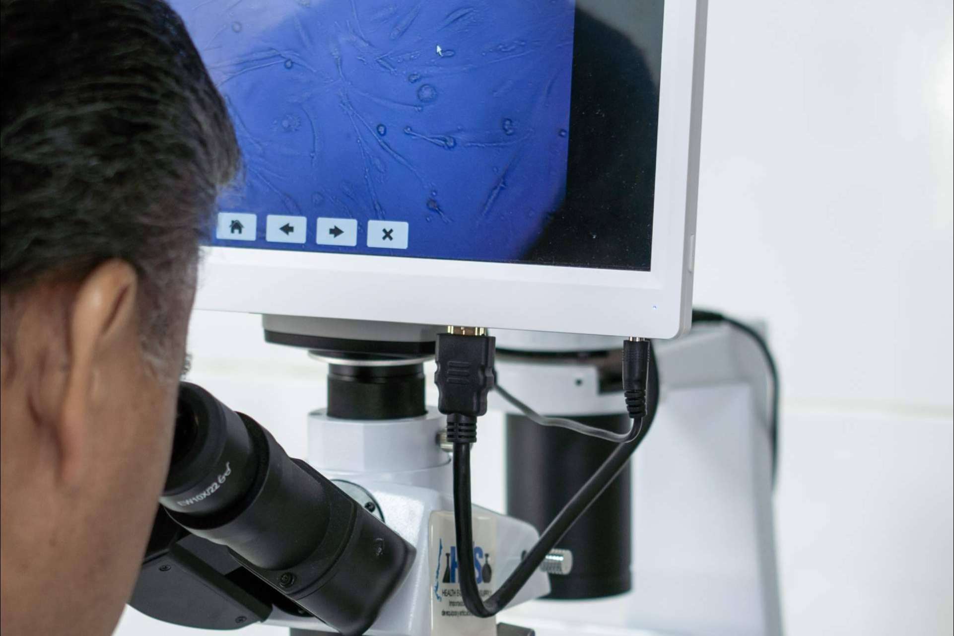 Seguridad y Transparencia con ONCOCIT RED CANCER para Vencer el Cáncer